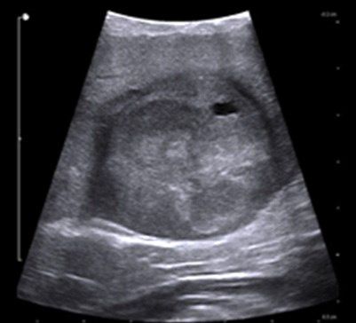 Изображение на обложке